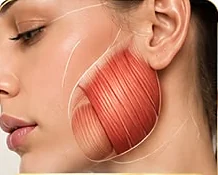 Anatomia da região masseter para estudo em Harmonização Orofacial